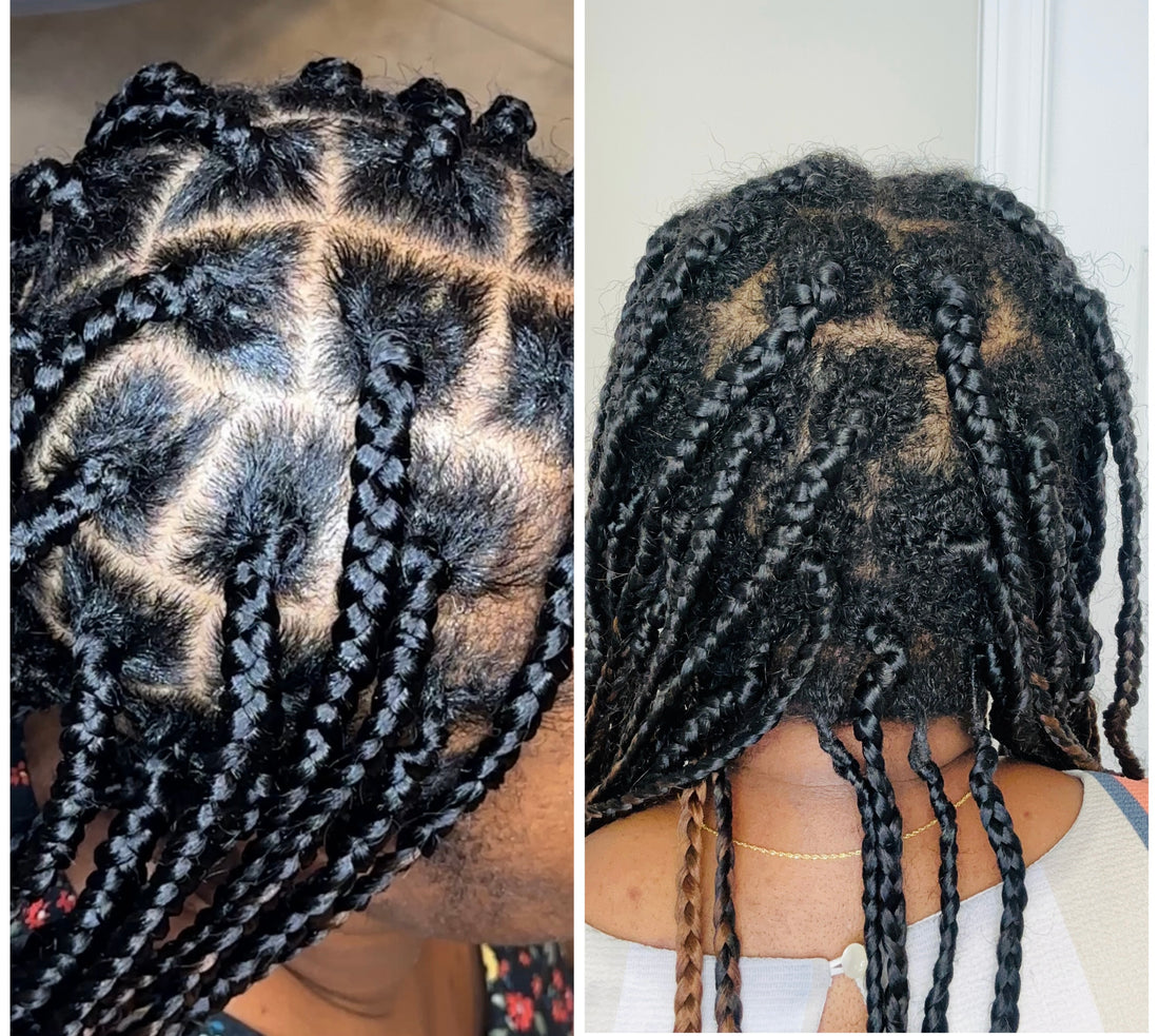 DISCOVER THE ULTIMATE SECRET TO FASTER HAIR GROWTH